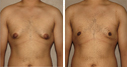 Before & After Photos